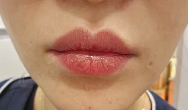 필오프 립 스테인 사용 후 최종 입술 발색 결과