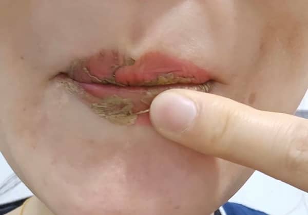 립 스테인 제거 시 손가락 색상 묻어남 테스트